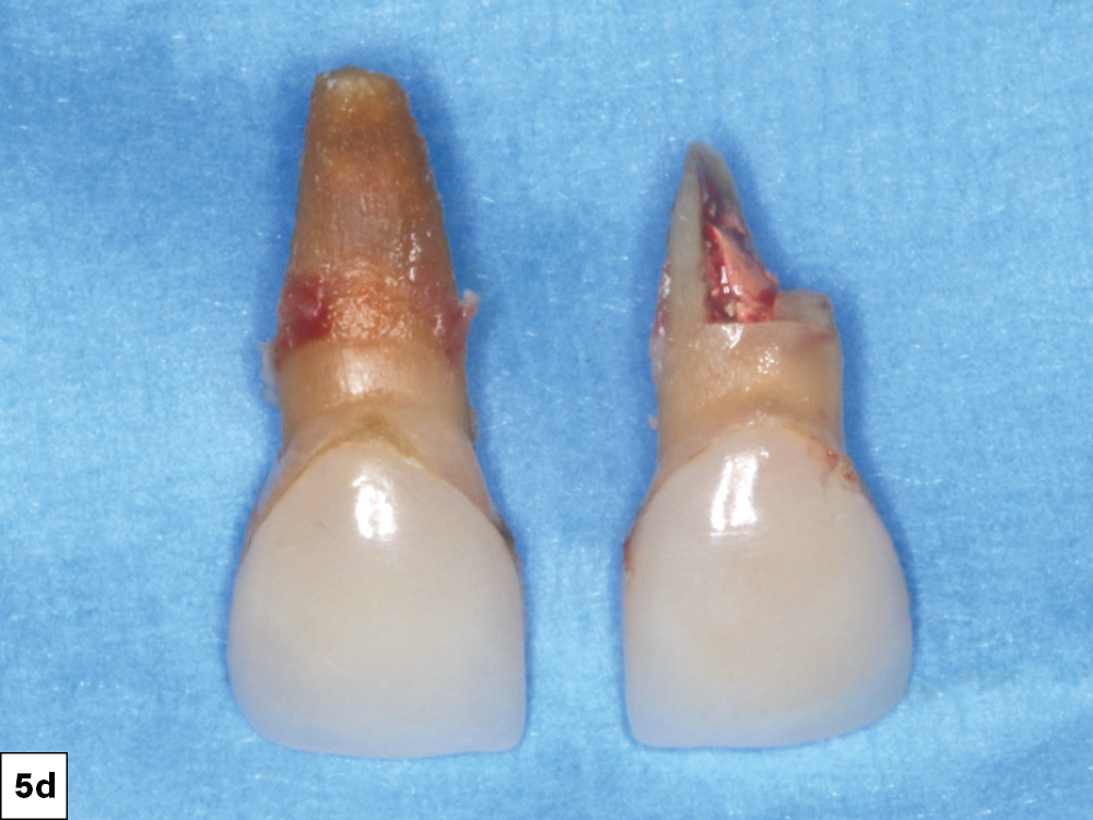 Figure 5d
