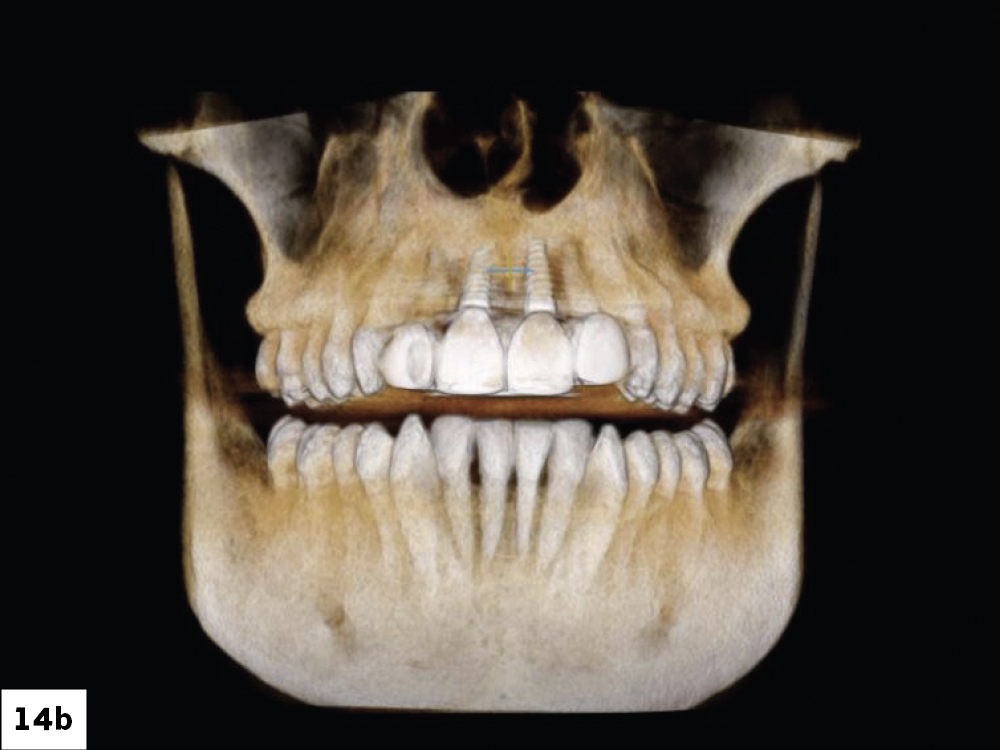 Figure 14b