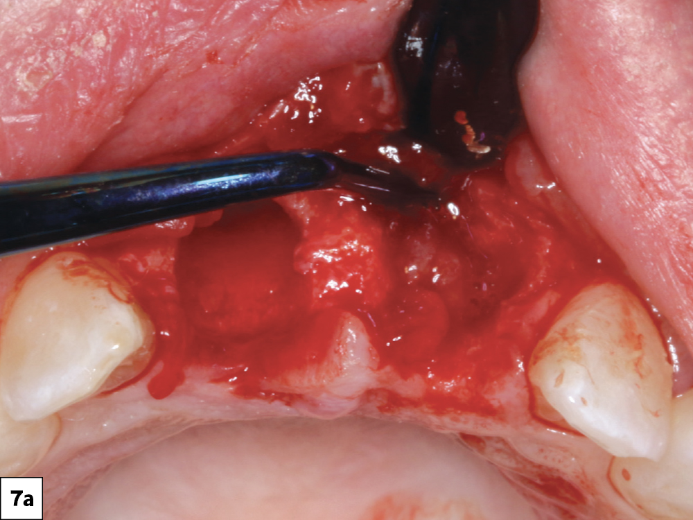 Figure 7a