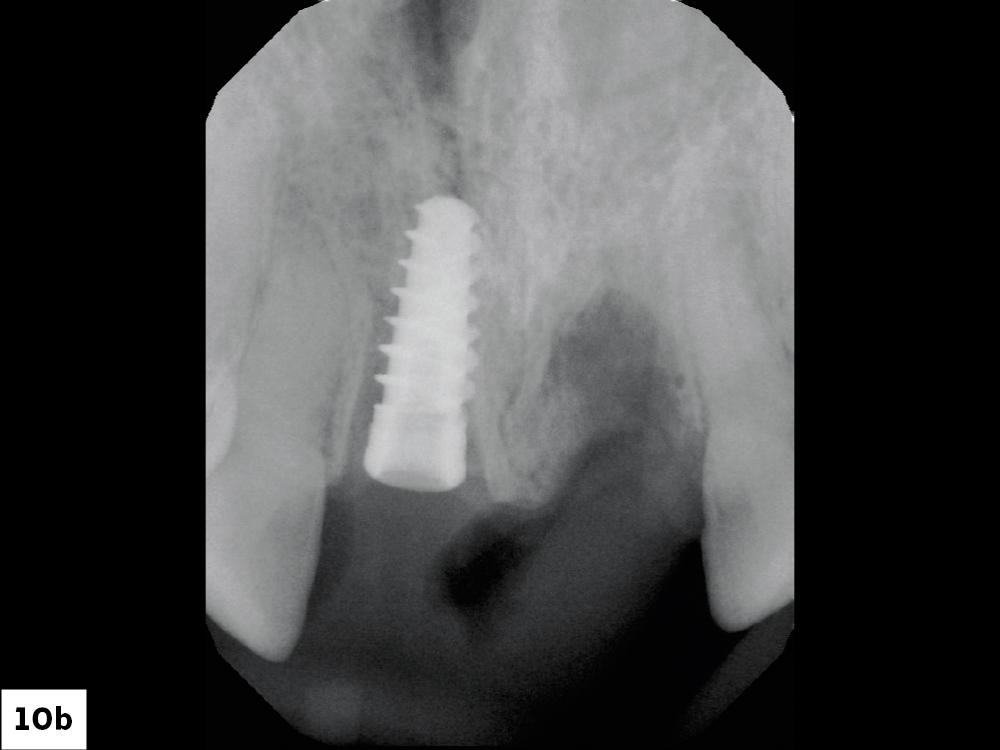 Figure 10b
