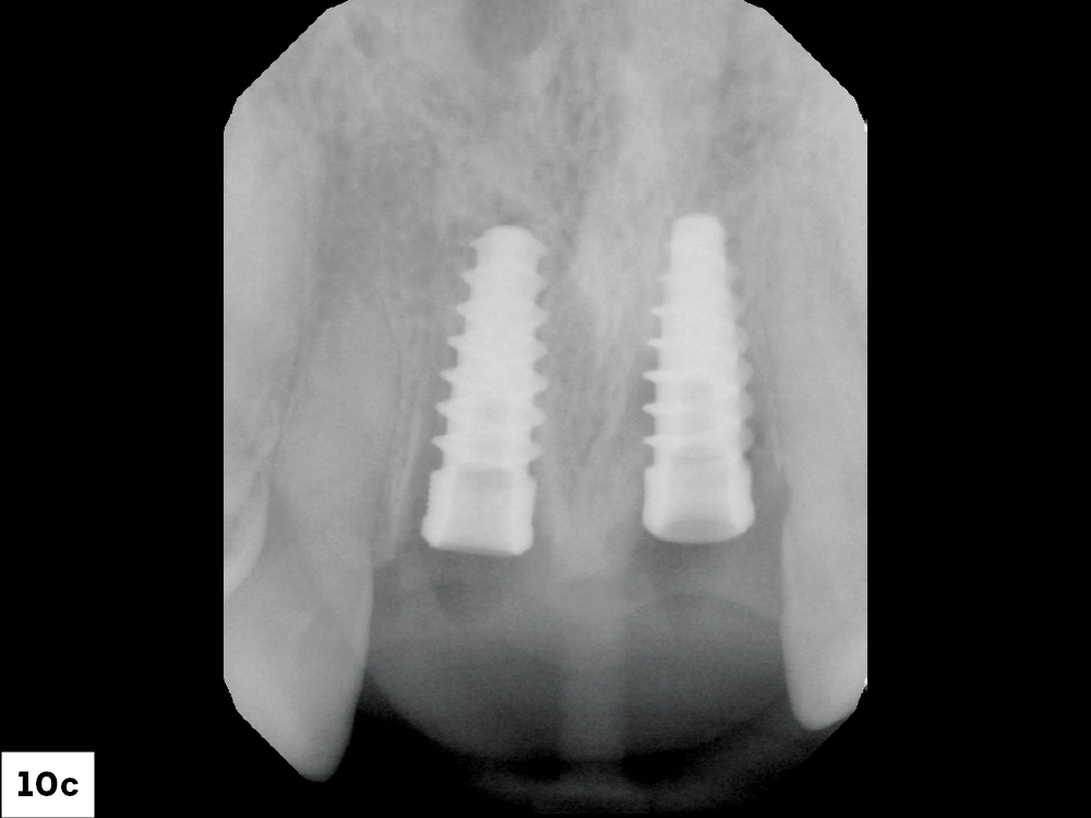 Figure 10c