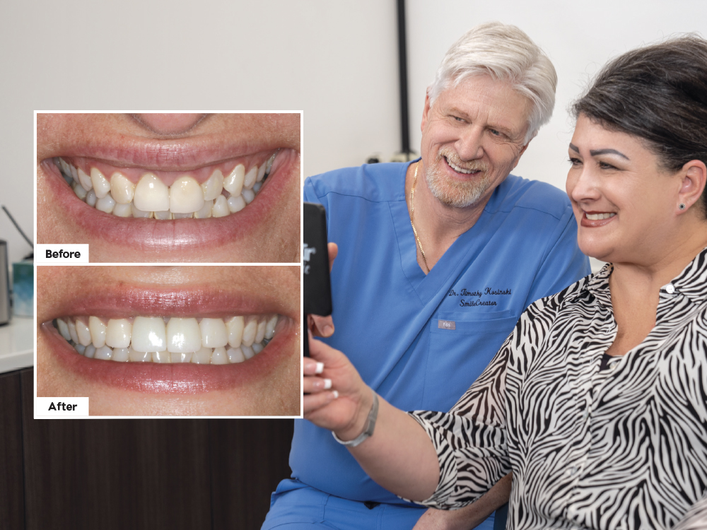 Socket Grafting and Immediate Implant Placement in the Esthetic Zone: A Case Study