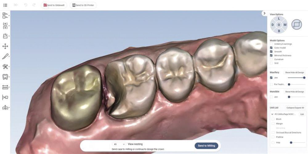 Figure 6: digital scan