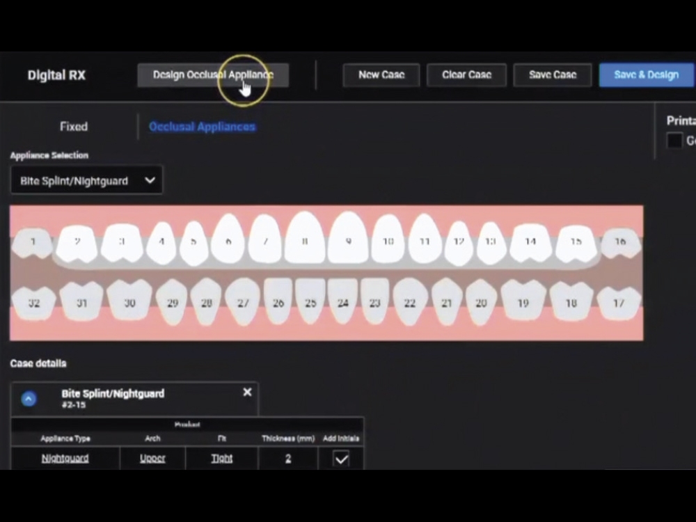 Using the fastdesign.io™ Software and Design Station to print occlusal guards