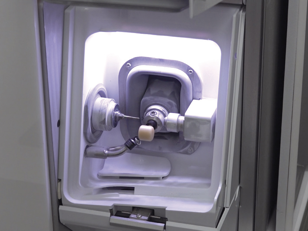 An in-office mill being used
