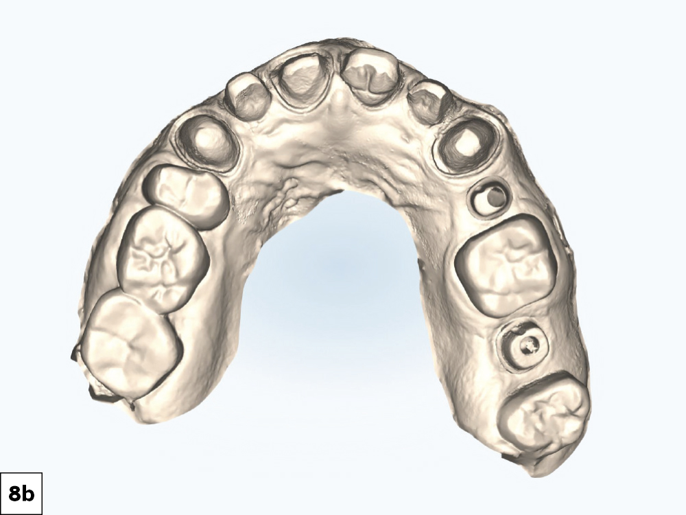 Figure 8b
