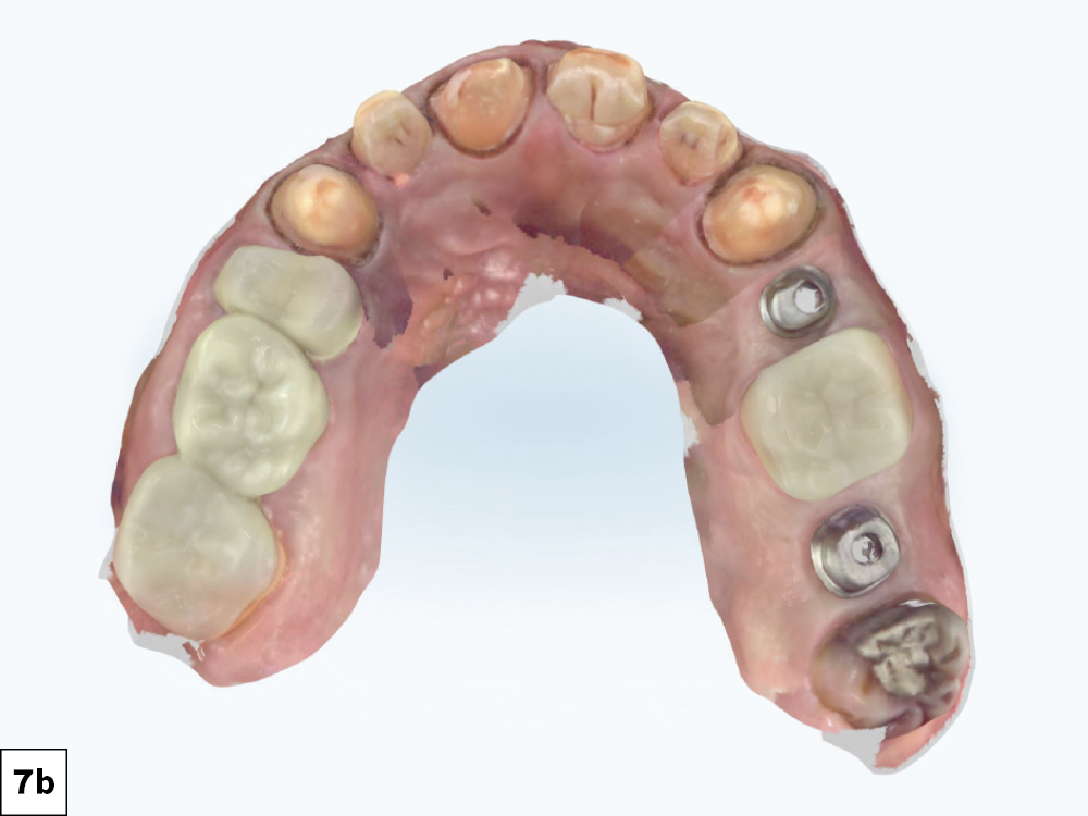 Figure 7b