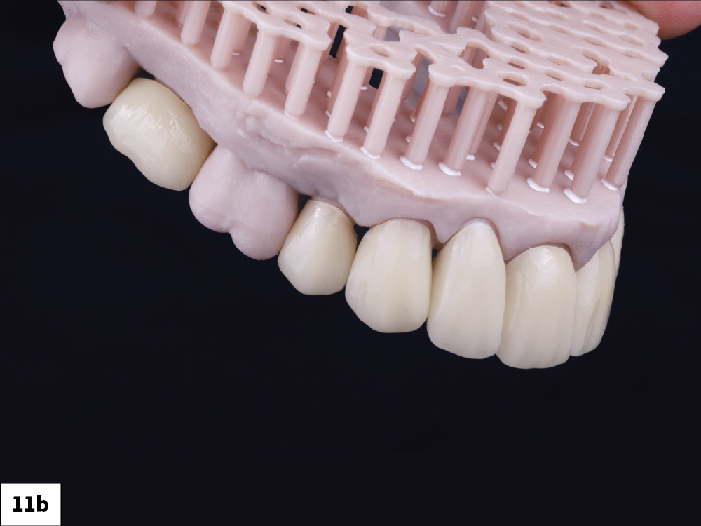 Figure 11b