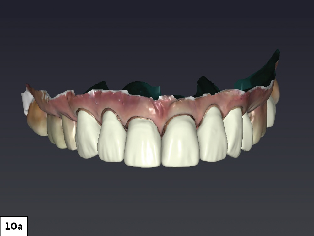 Figure 10a