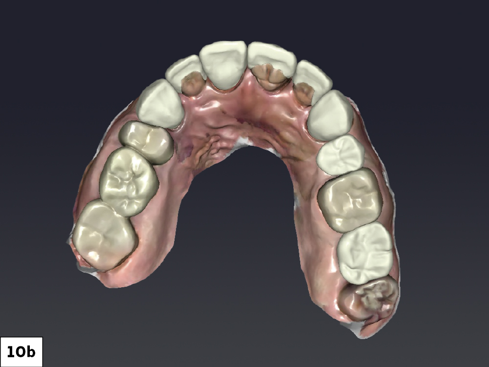 Figure 10b