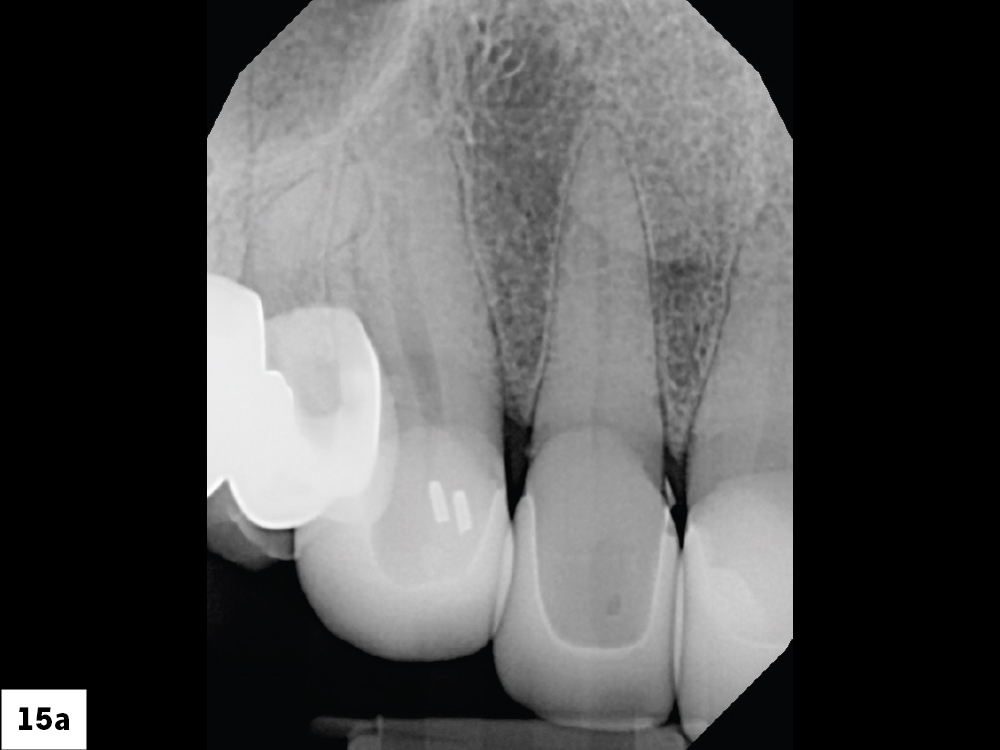 Figure 15a