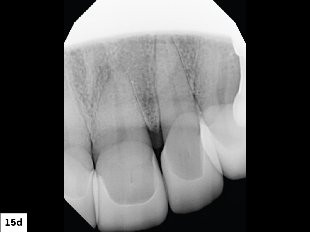 Figure 15d