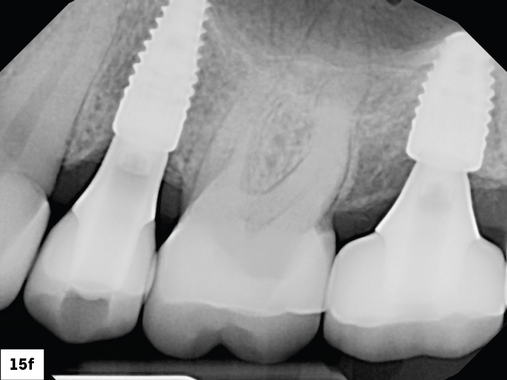 Figure 15f