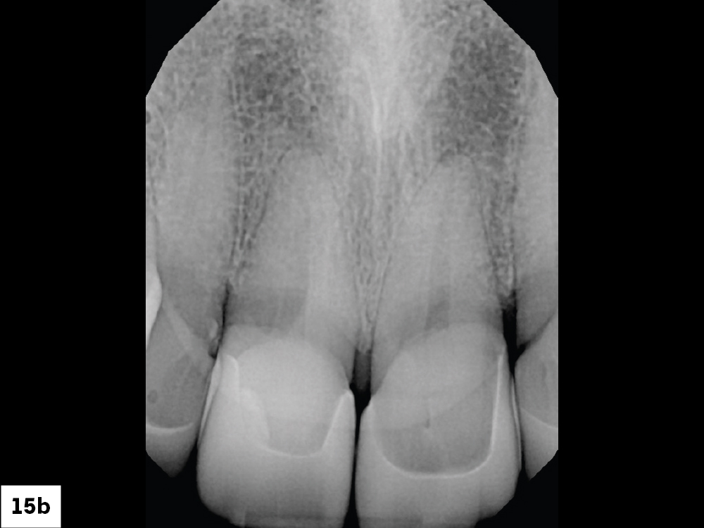 Figure 15b