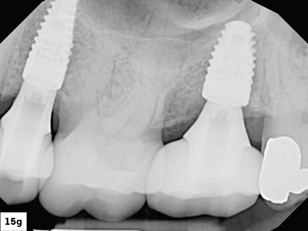 Figure 15g