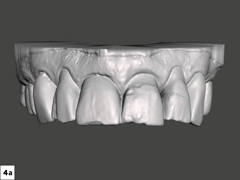 Figure 4a