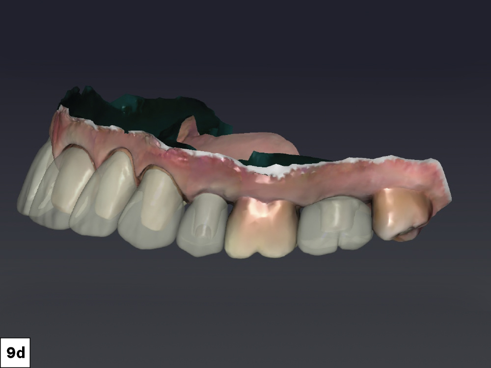 Figure 9d