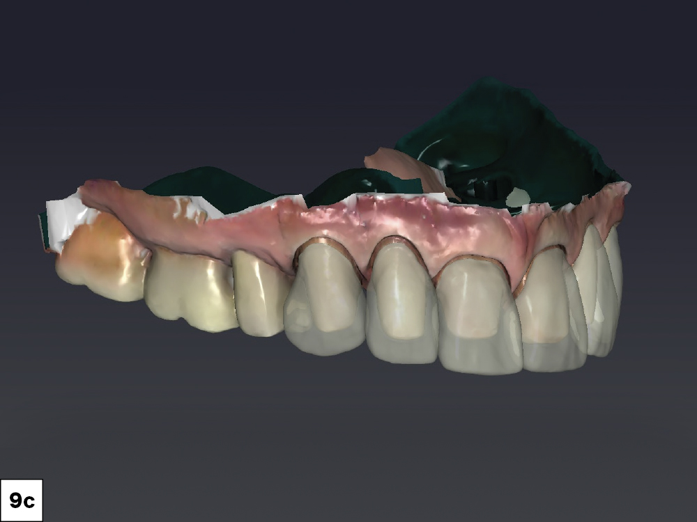 Figure 9c