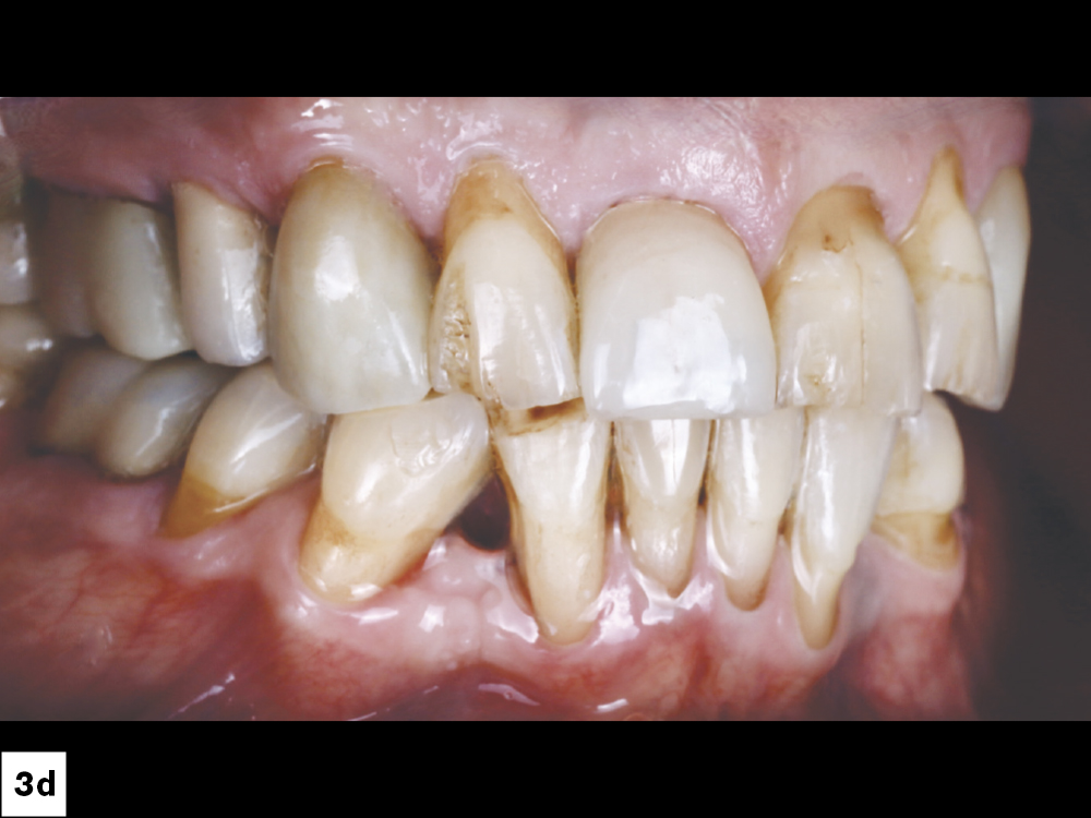 Figure 3d