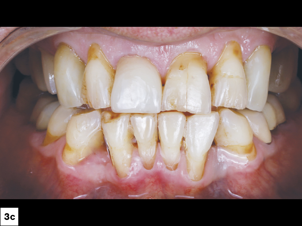 Figure 3c