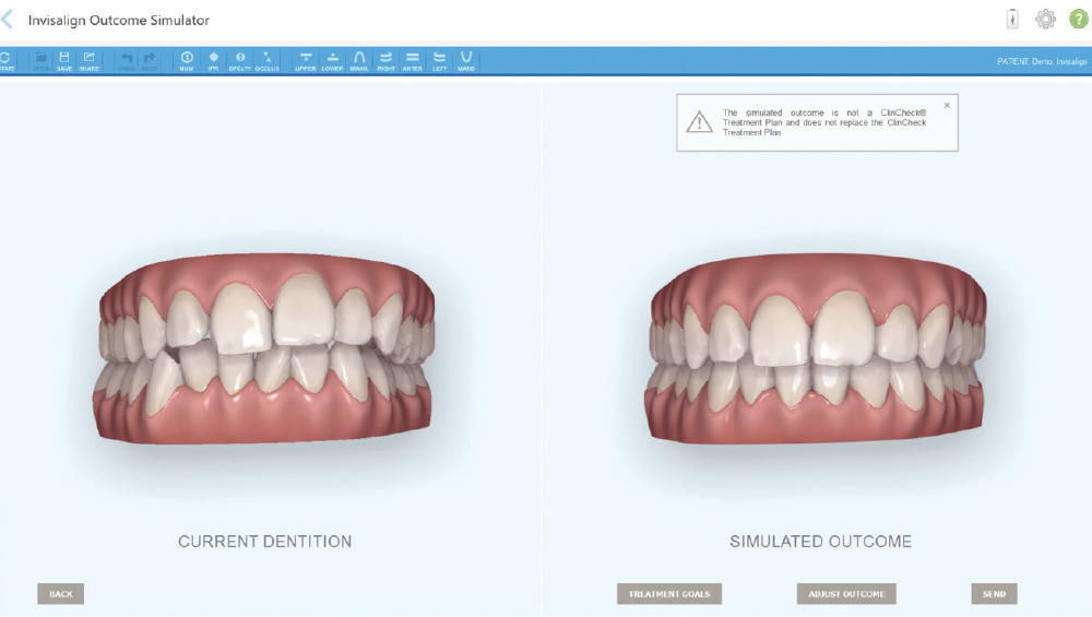 Intraoral scanners aid in illustrating treatment plans chairside.