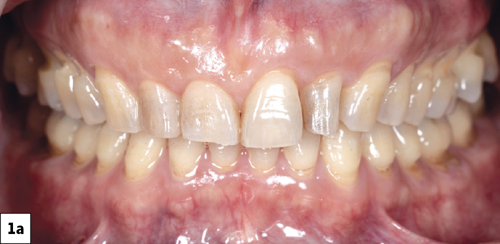 Close-up of human teeth and gums