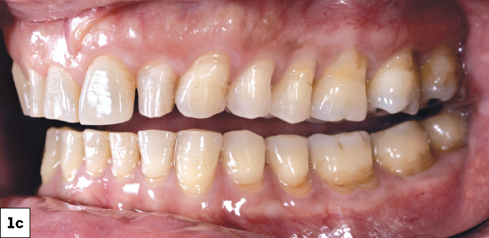 Close-up of human teeth and gums
