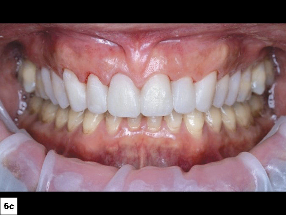 Close-up of human teeth and gums
