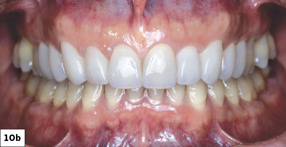 Close-up of human teeth and gums
