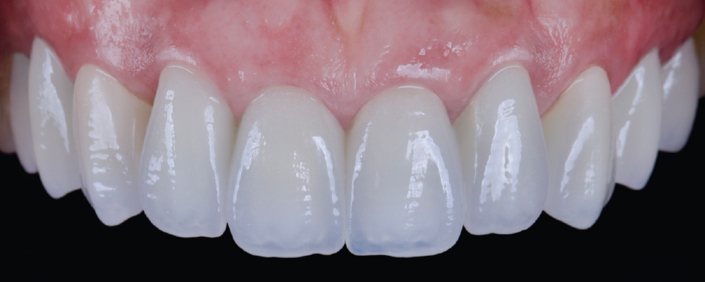 Close-up of natural white teeth