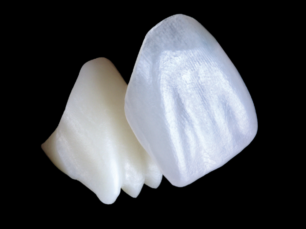 Close-up of dental veneers on black background