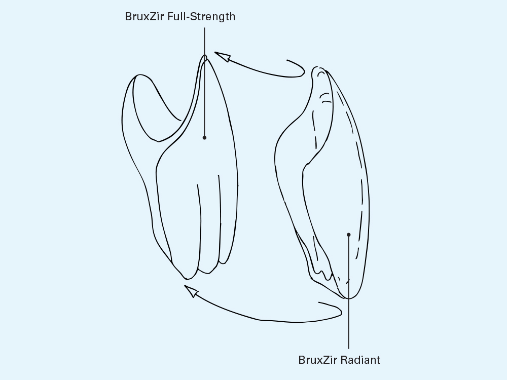 BruxZir Full-Strength and Radiant Comparison