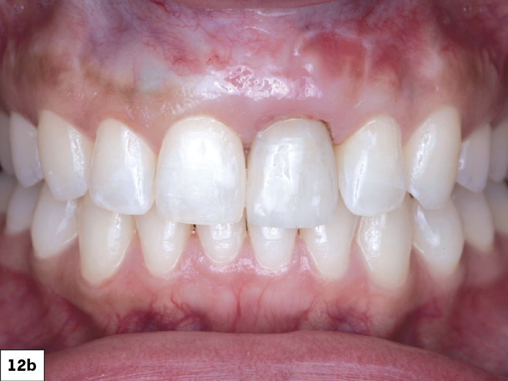 Close-up of human teeth and gums