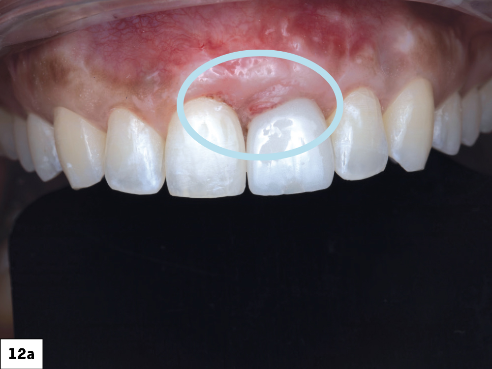 Close-up of teeth with dental focus