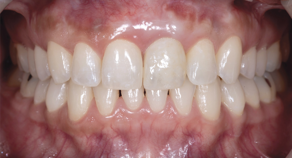 Close-up of human teeth and gums