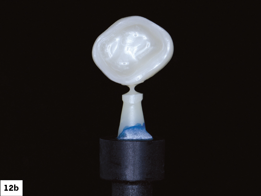 The fastmill.io milled a beautiful and translucent BruxZir Esthetic NOW Posterior crown-1