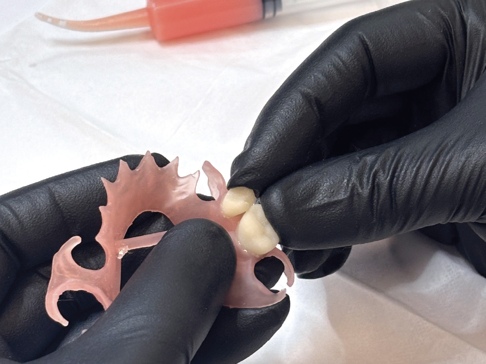 Bonding teeth to partial base