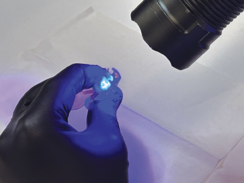 Inspecting Flexible Partial Dentures under blacklight