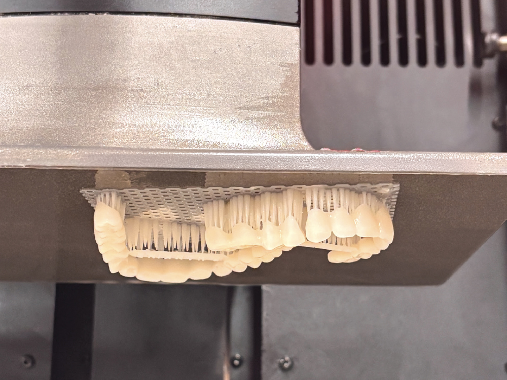 Light curing partial teeth