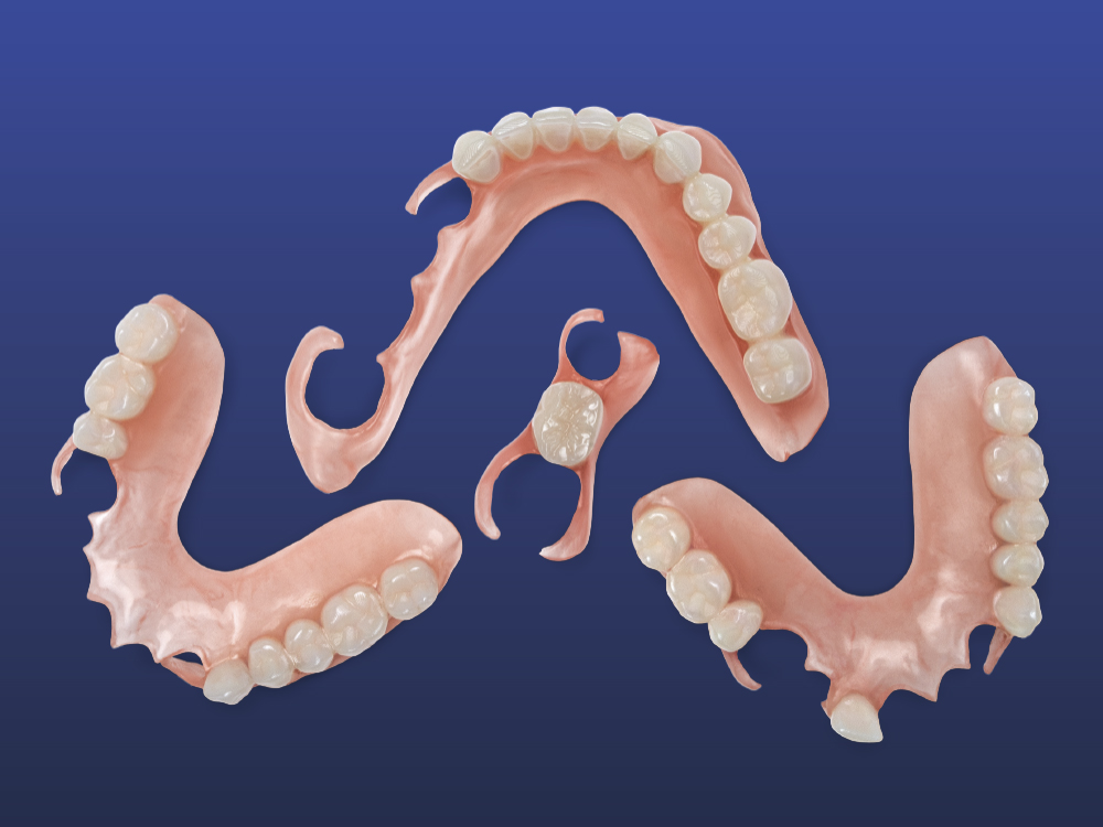 Redefining Flexible Partial Dentures