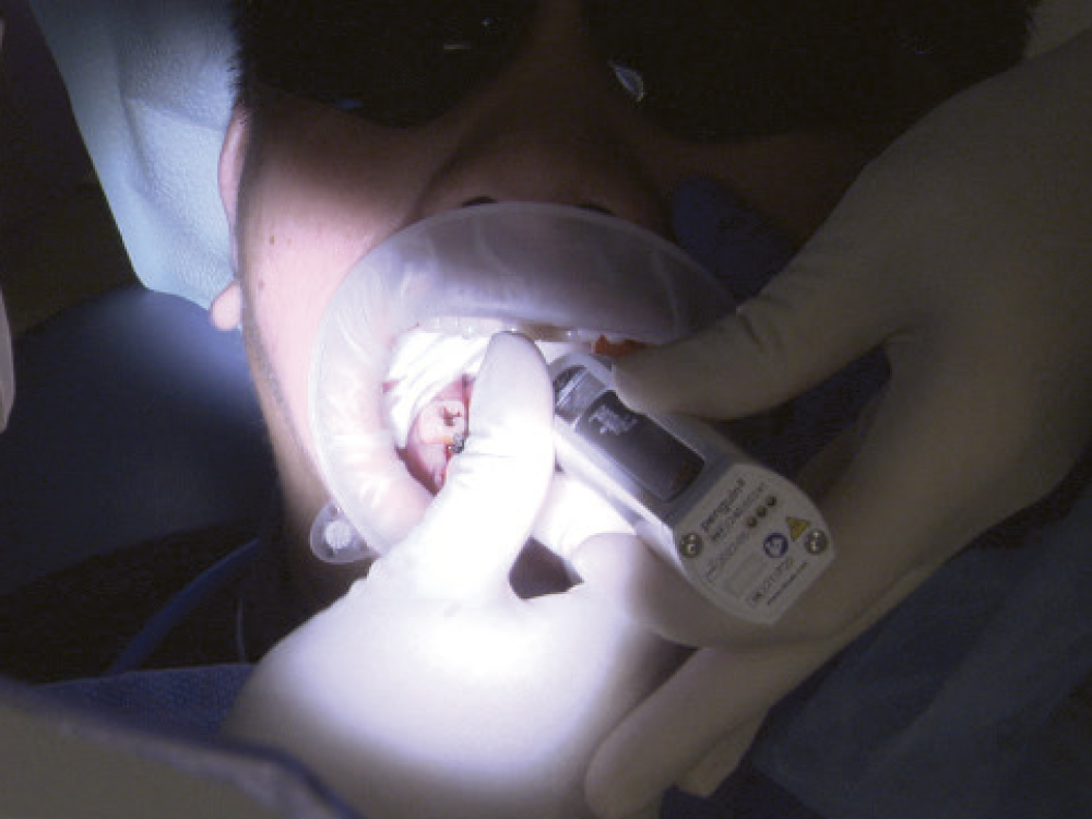 Usage of a Penguin RFA Device 