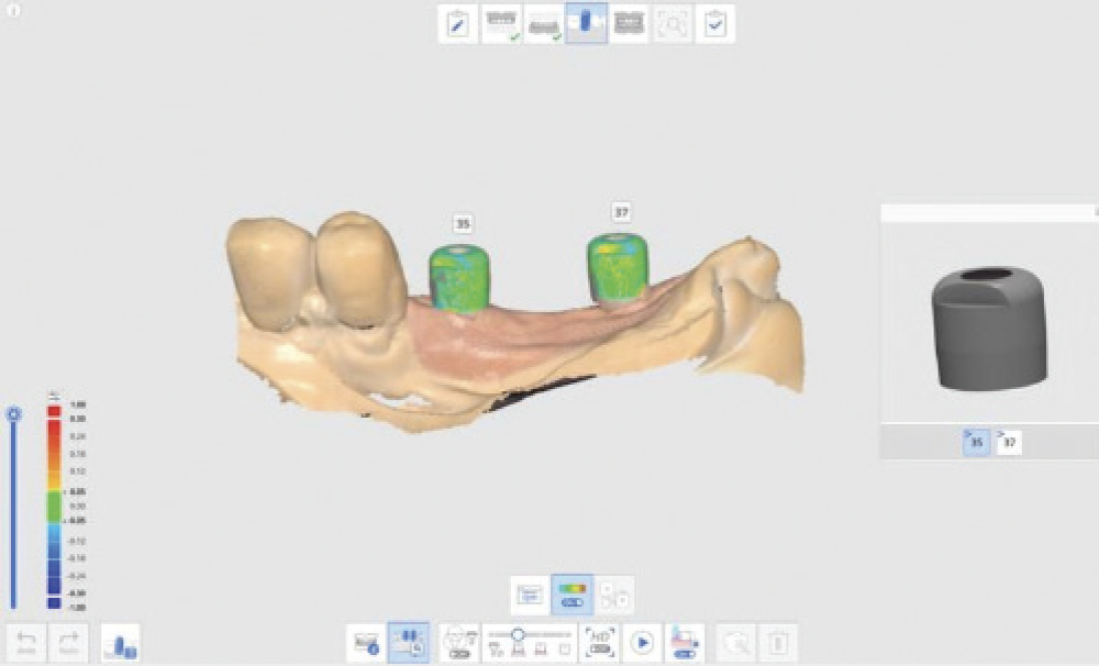 AI-Assisted Scan Detection