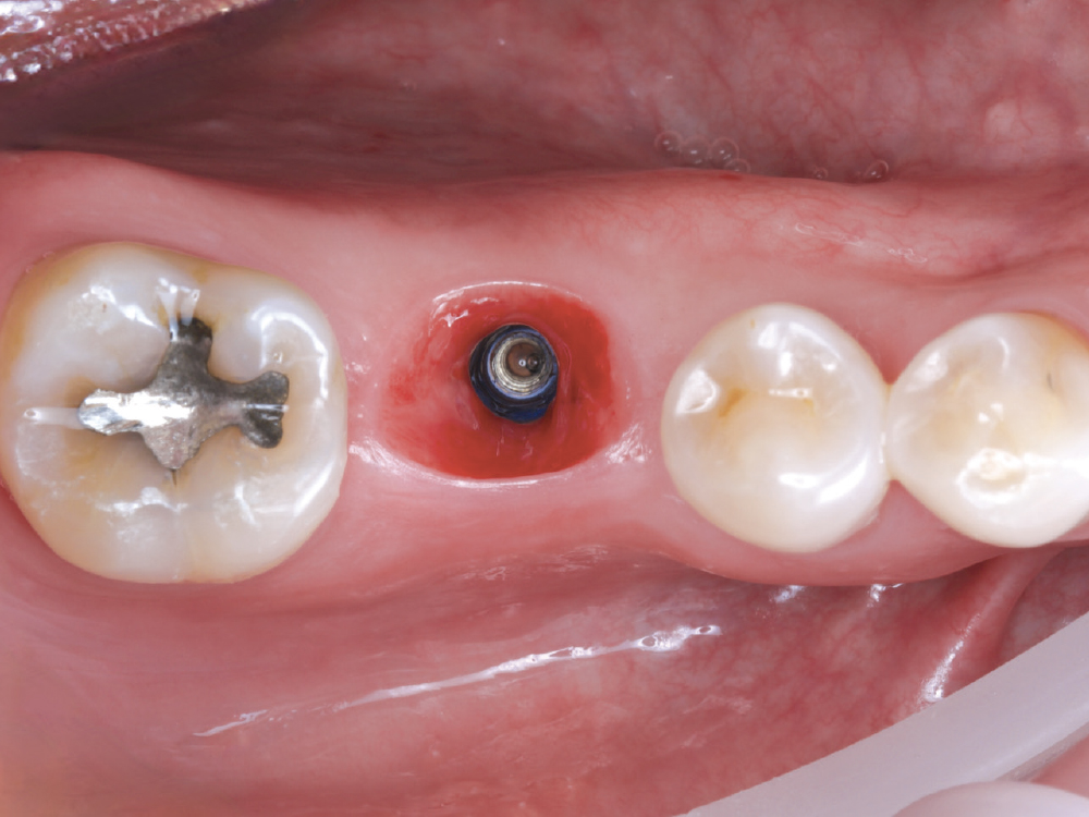 Pre-Scan Preparation