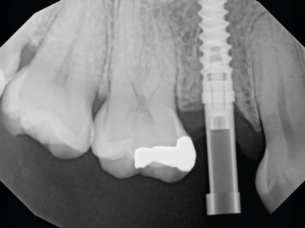 Verify Complete Scan Body Seating