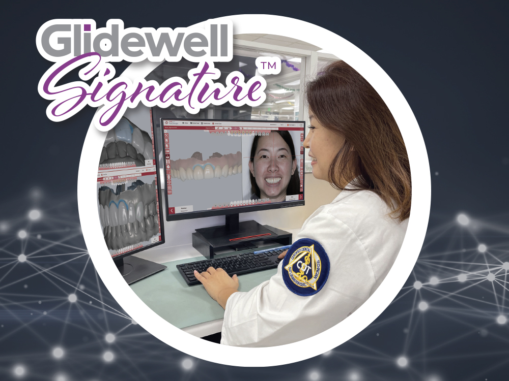 Introducing a Guided  Start-to-finish Workflow for Esthetic Cases