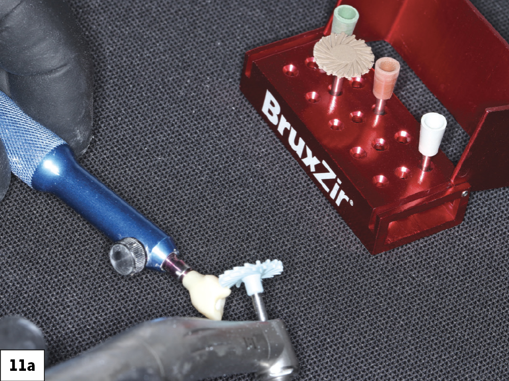 The fastmill.io unit milled each restoration in approximately thirty-five minutes