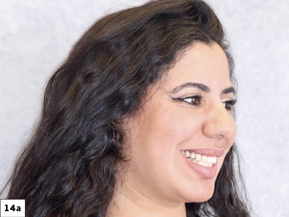 The transformation for the patient was immediate