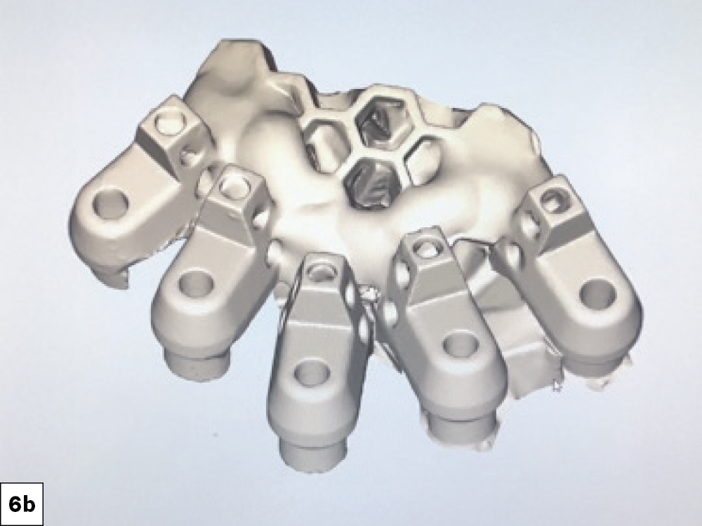 Extraoral Scanning of OptiSplint