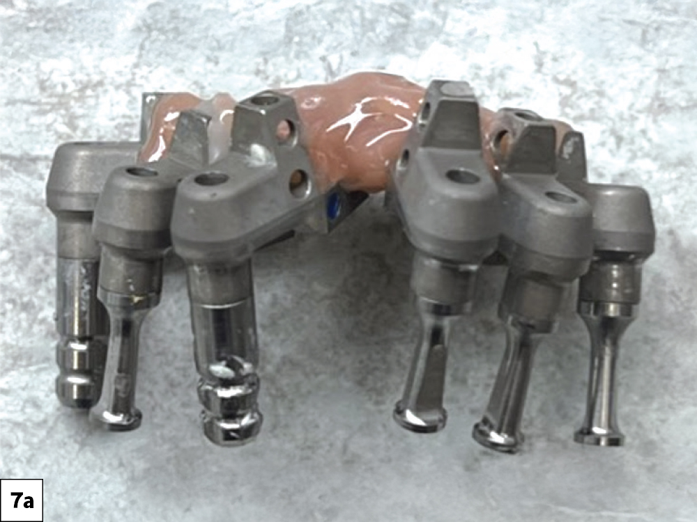 Inserting Multi-Unit Analogs