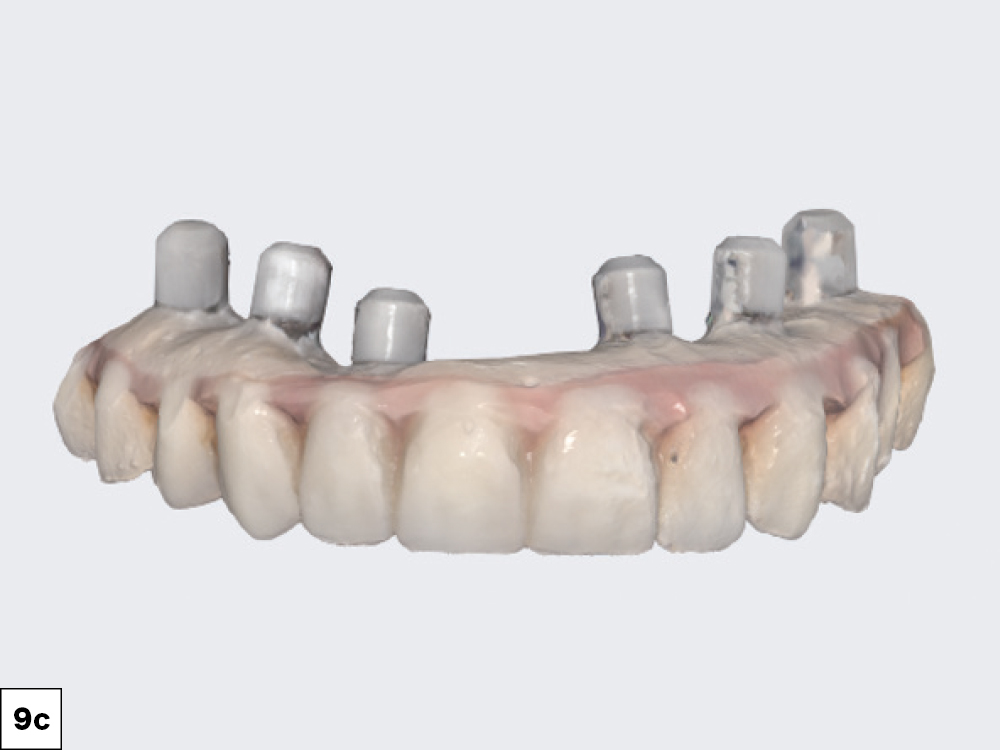 Scannable Analogs Inserted